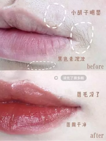 小红书引流推广,只需4招! 小红书引流推广,只需4招!