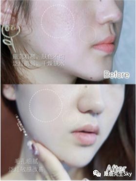 你的笔记“限流”真的不怪小红书! 你的笔记“限流”真的不怪小红书!