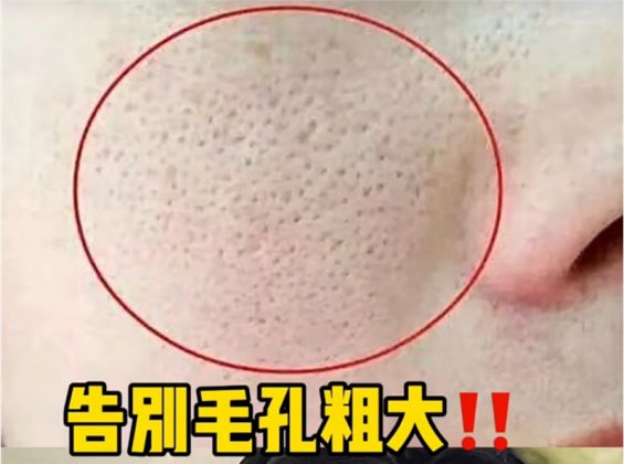 小红书薯条审核规则指南