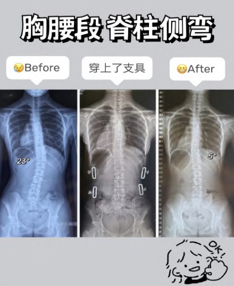 小红书薯条审核规则指南