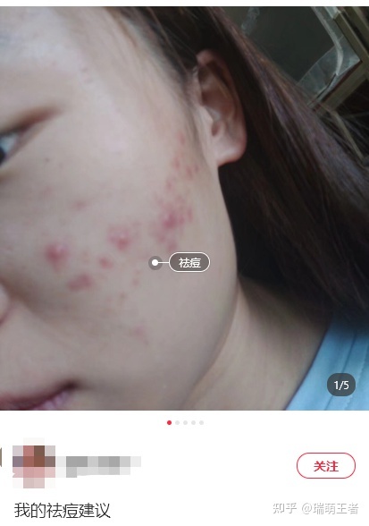 小红书推广技巧，品牌如何找到专业的小红书推广公司？