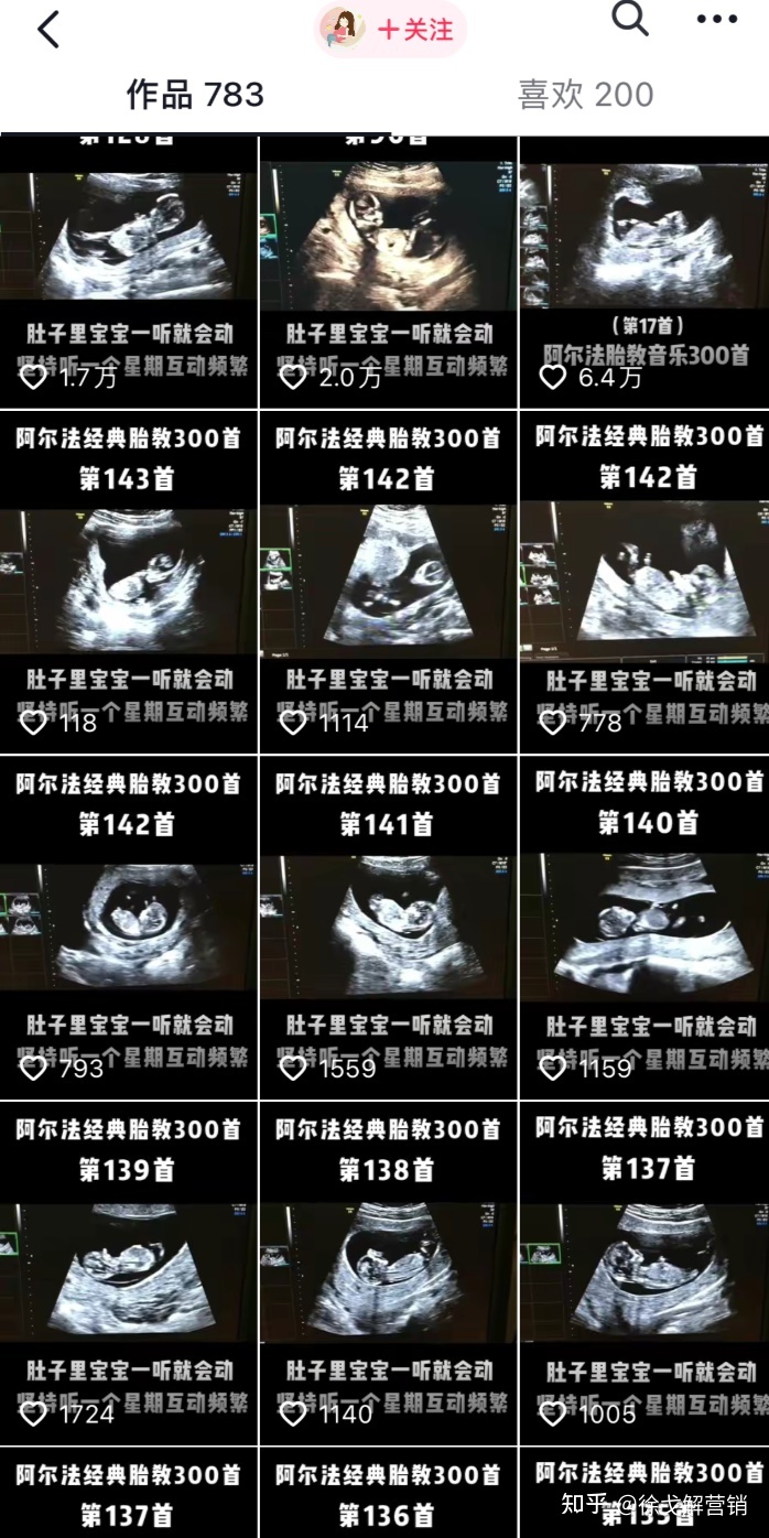 “小孩的钱最好挣”，抖音、视频号项目生死起盘指南