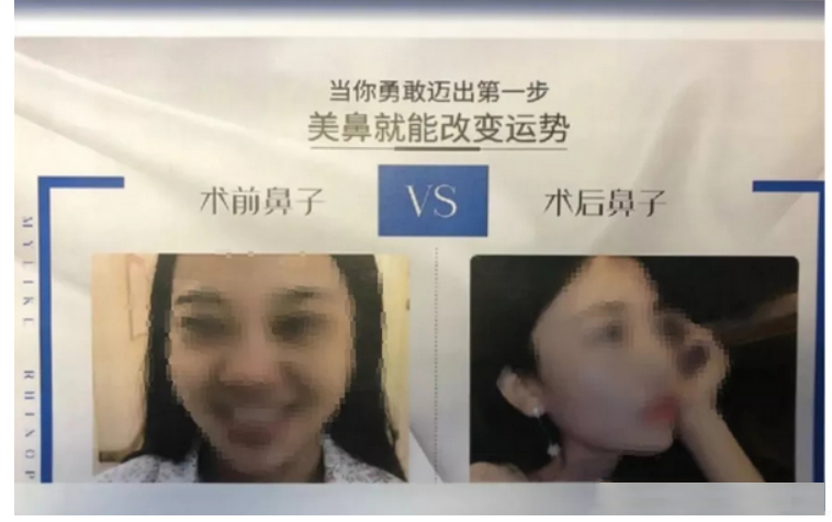 商家怎样避免虚假宣传违规？虚假广告典型案例