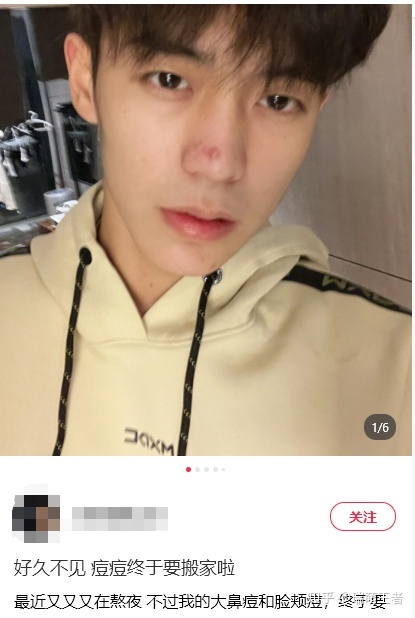 小红书推广技巧，品牌如何找到专业的小红书推广公司？